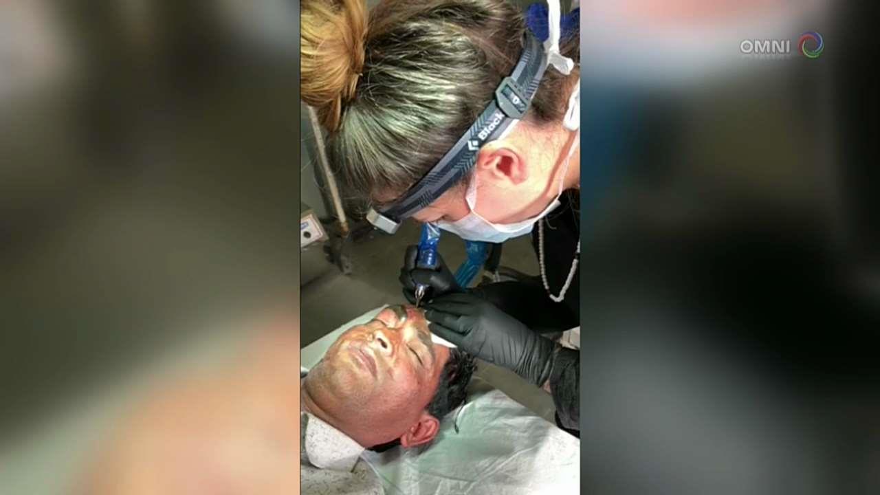 Toronto tattoo artist restoring acid-burned faces in India