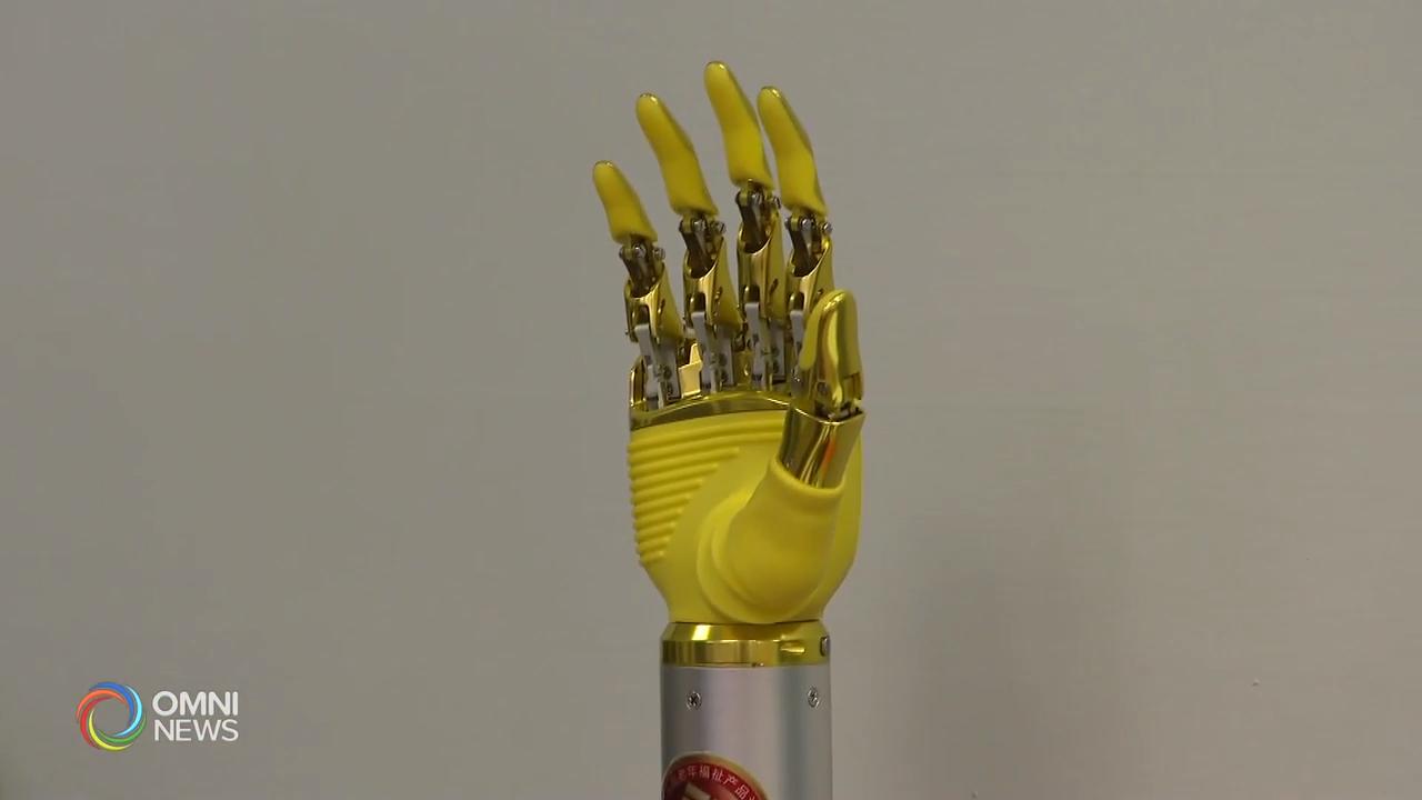 世界上最先进人工智能仿生手，加拿大华人研发 – Aug 13, 2019 (ON)
