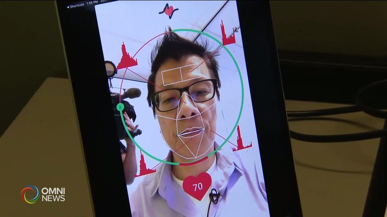 多伦多大学团队，研发出用手机自拍量血压 – Aug 30, 2019 (ON)