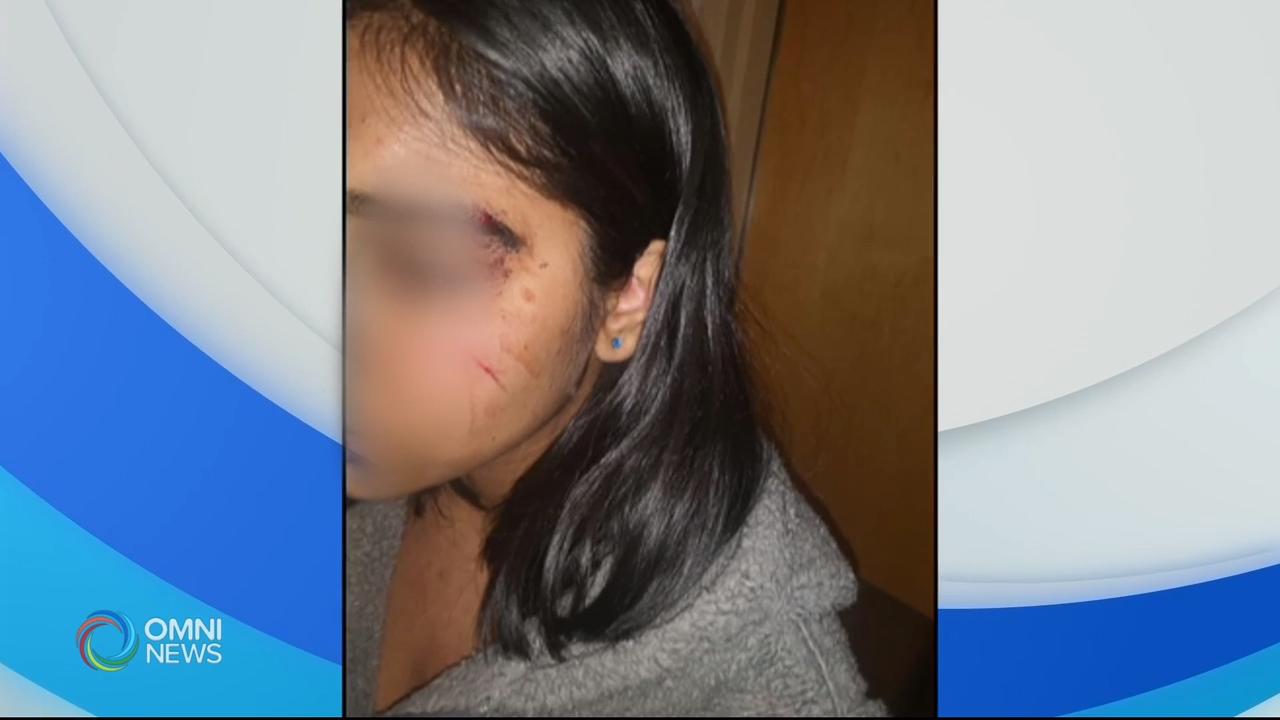 POCO Family Questions Police Conduct