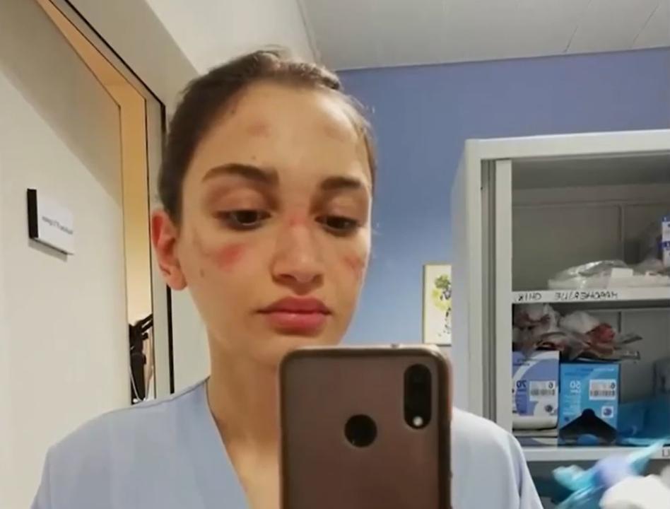 Skin itchy after wearing masks for long hours?