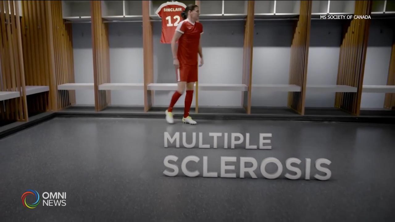 Sinclair and Burgers to Beat MS