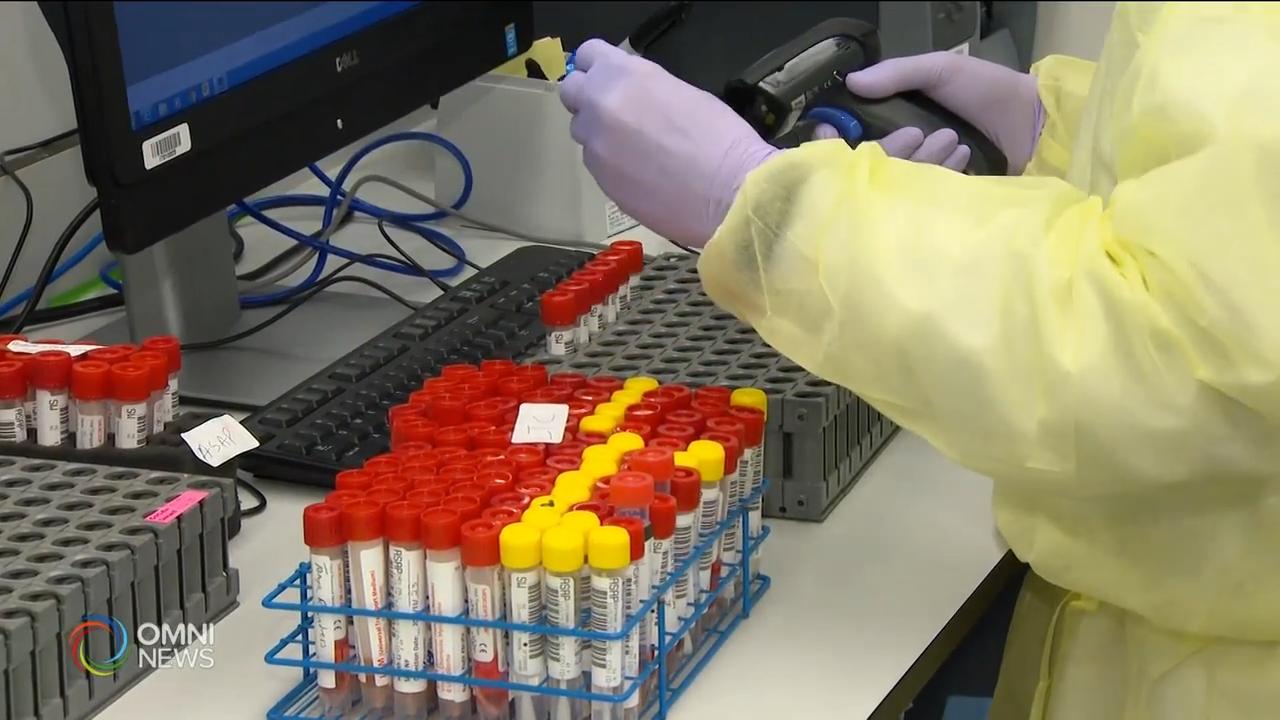 检测中心24小时不停运作 -- Nov 27, 2020 (ON)